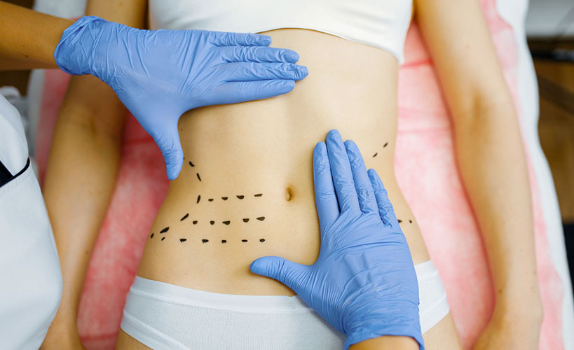 lipo enzimática