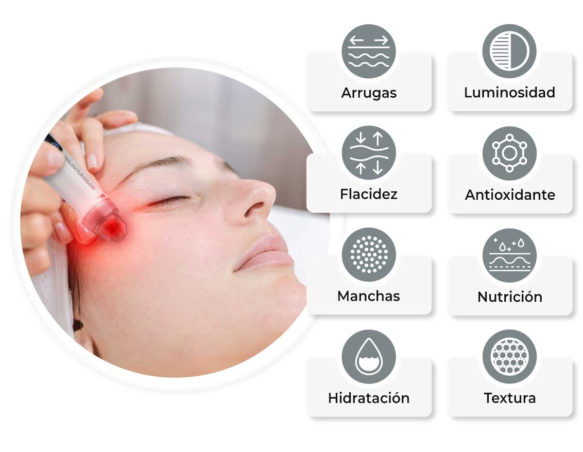 caraterísticas y beneficios de microneedling lhea